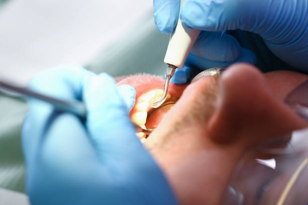 Best Emergency Dental Surgery in West Monroe, MI